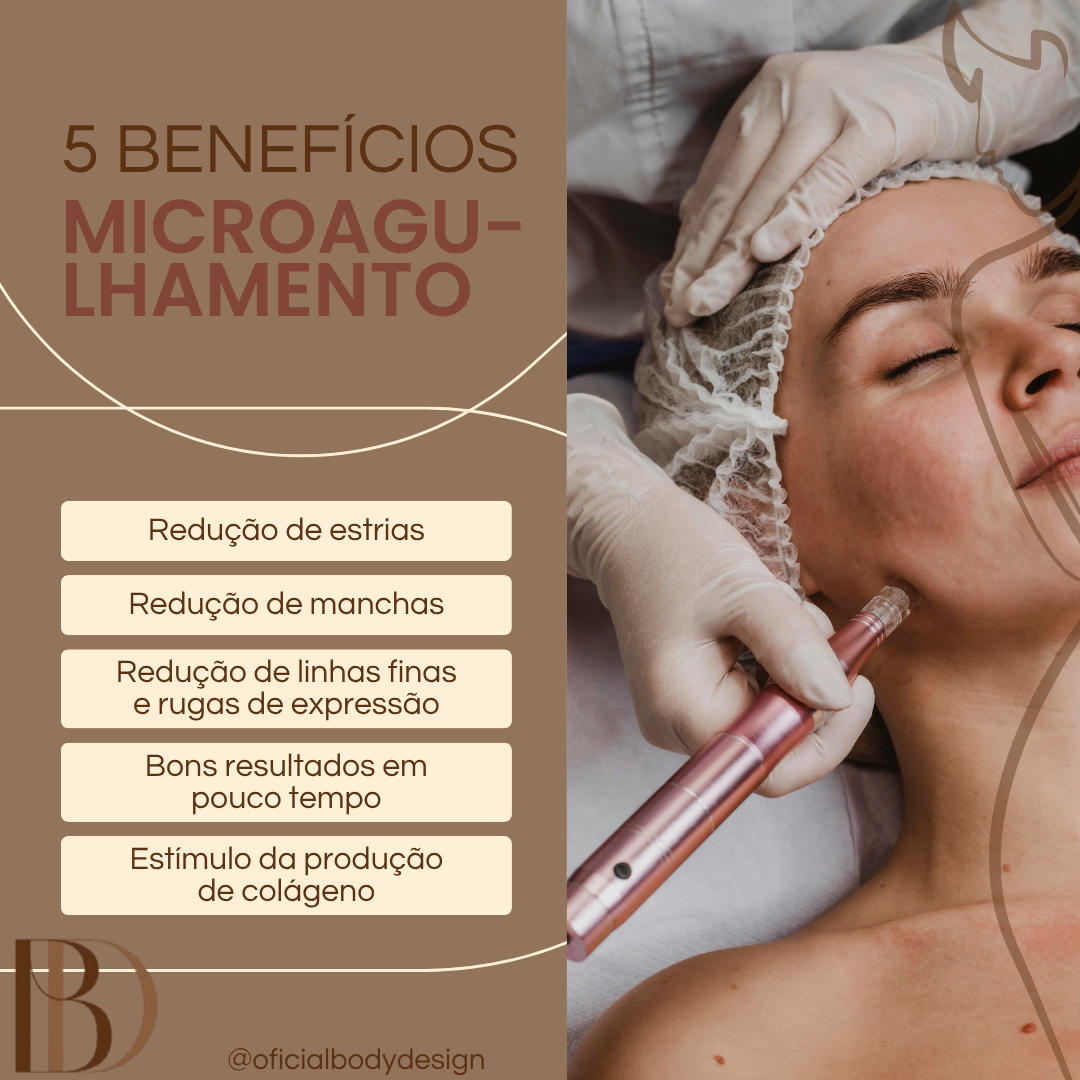 Microagulhamento