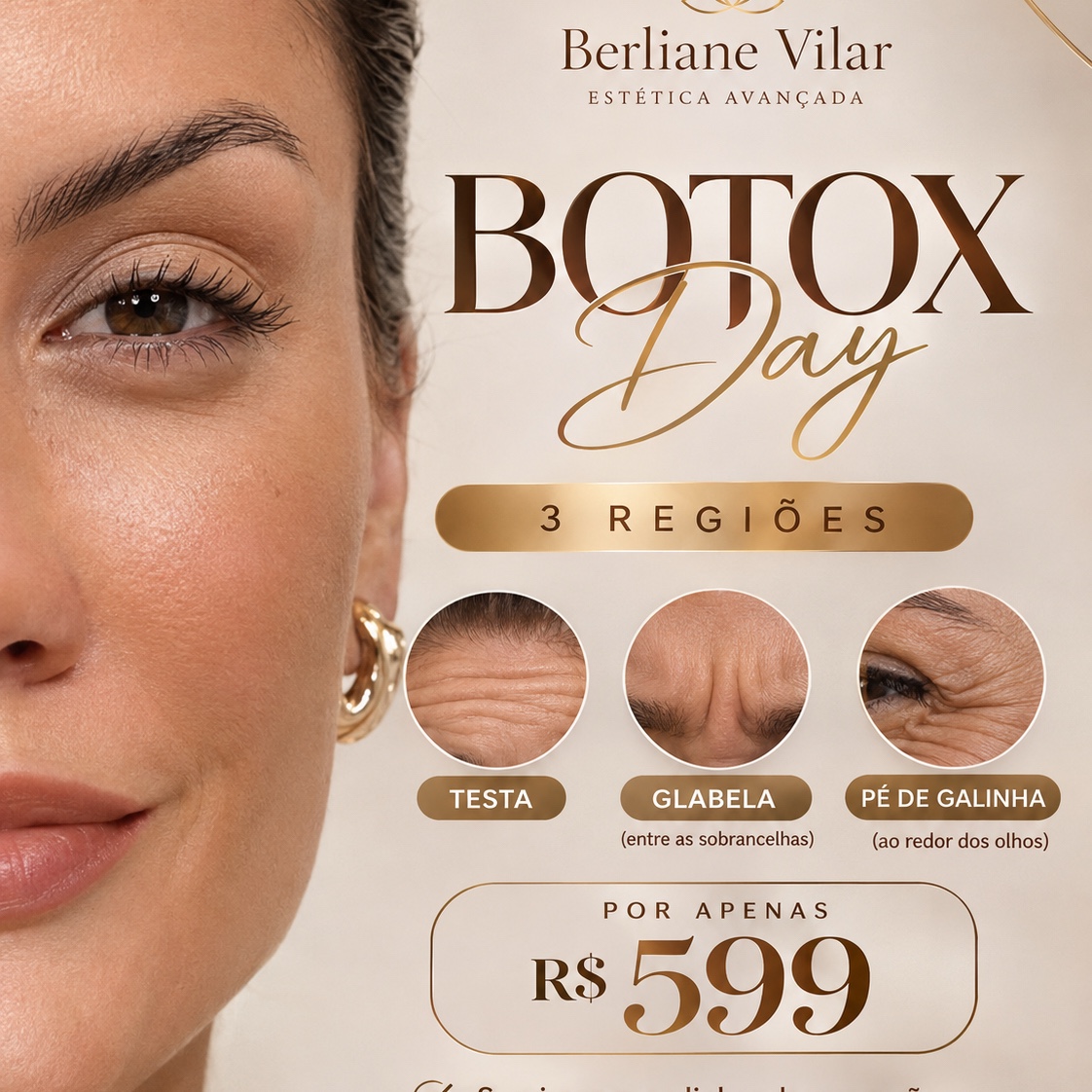 botox